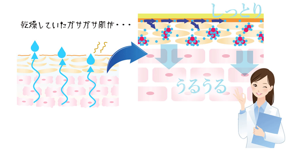 乾燥していたガサガサ肌が・・・しっとりうるうる